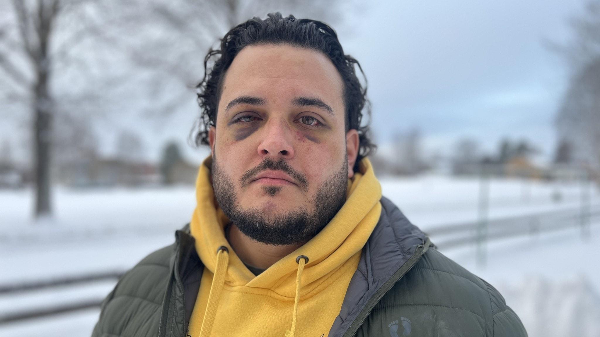 Felix sa ifrån mot rasism – blev slagen och strypt